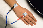 BioTab electrodes attached to hand 